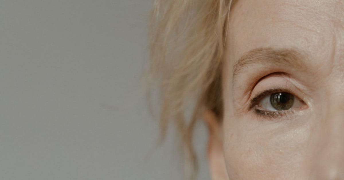 Pálpebra caída ou excesso de pele, artigo da Dra. Fernanda Zorzin, plástica ocular, Bella Vita, Brasília